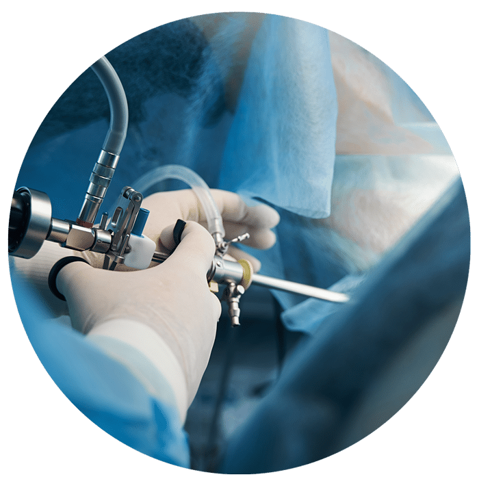 Minivasive Pain Knee Surgery