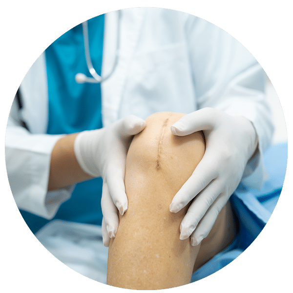 Minivasive Pain Knee Surgery