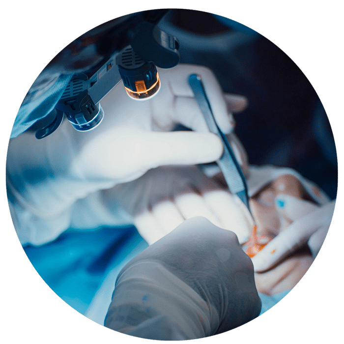 Minivasive Pain Knee Surgery