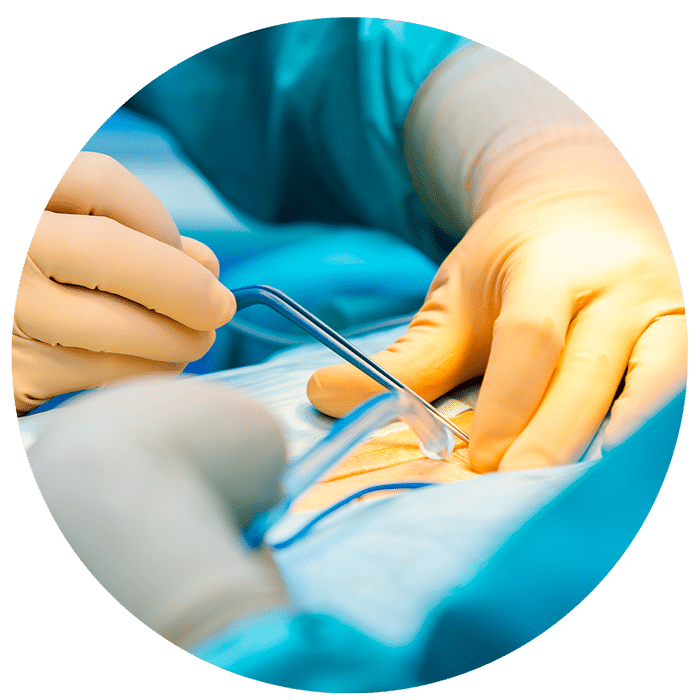 Minivasive Pain Knee Surgery