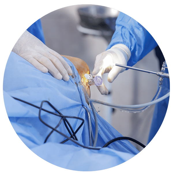 Minivasive Pain and Orthopedics ACL