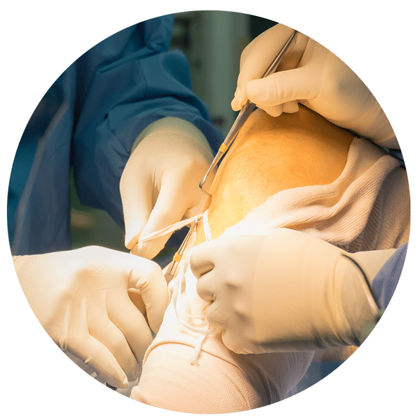 Minivasive Pain Knee Surgery