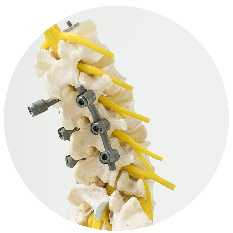 Minivasive Pain and Orthopedics ACL